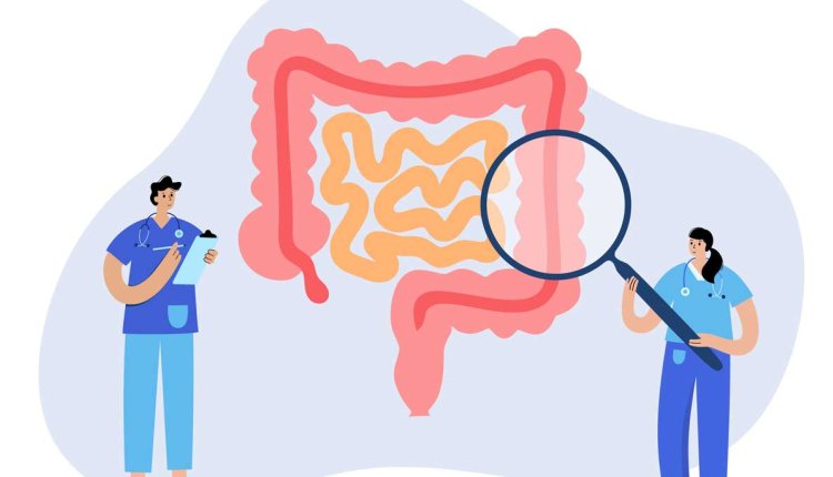 illustratie van artsen die zoeken naar dikke darmkanker