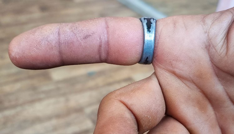 Man met opgezette vinger met vastzittende ring